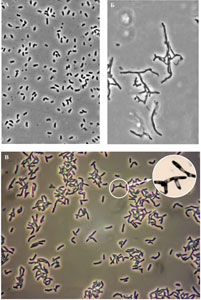 Морфология клеток R. ruber, выращенных на мясопептонном агаре. Фазово-контрастная микроскопия