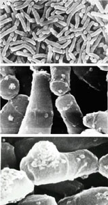 Клетки R. ruber ИЭГМ 87, выращенные на агаризованной минерально-солевой среде в присутствии пропана, в сканирующем электронном микроскопе