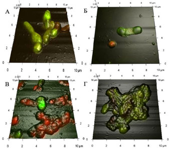 Совмещённые 3D АСМ-КЛСМ изображения клеток R. ruber ИЭГМ 346, выращенных в течение 10 сут в минерально-солевой среде в присутствии глюкозы и экотоксиканта