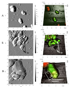  (1)   3D - (2)   R. rhodochrous  66