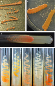     Rhodococcus